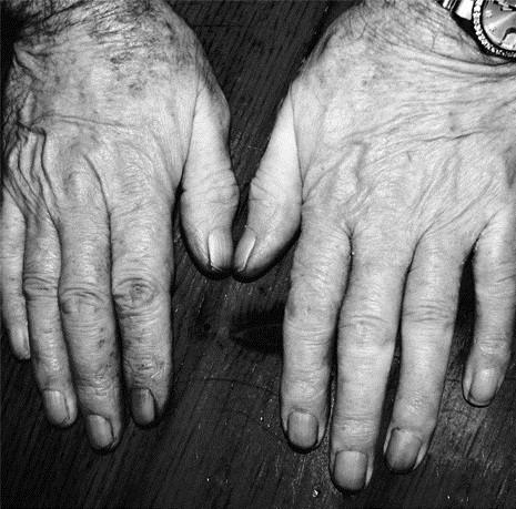 Grace (87), Tide Of Iron - The Hard Work E.P.