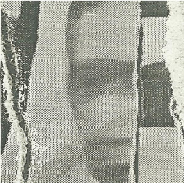 Overbite (2) - Overbite