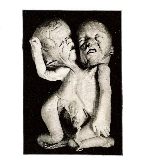 Sudden Infant, The Grey Wolves, Macronympha - Interzone 3