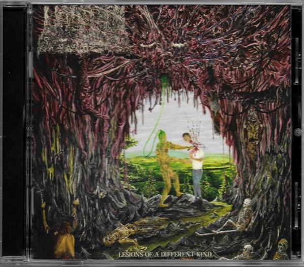 Undeath - Lesions Of A Different Kind